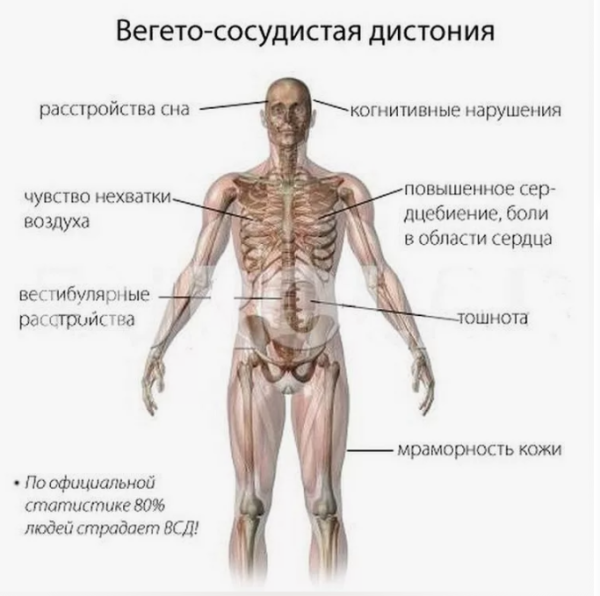 Вегетососудистая дистония от А до Я [Павел Федоренко]